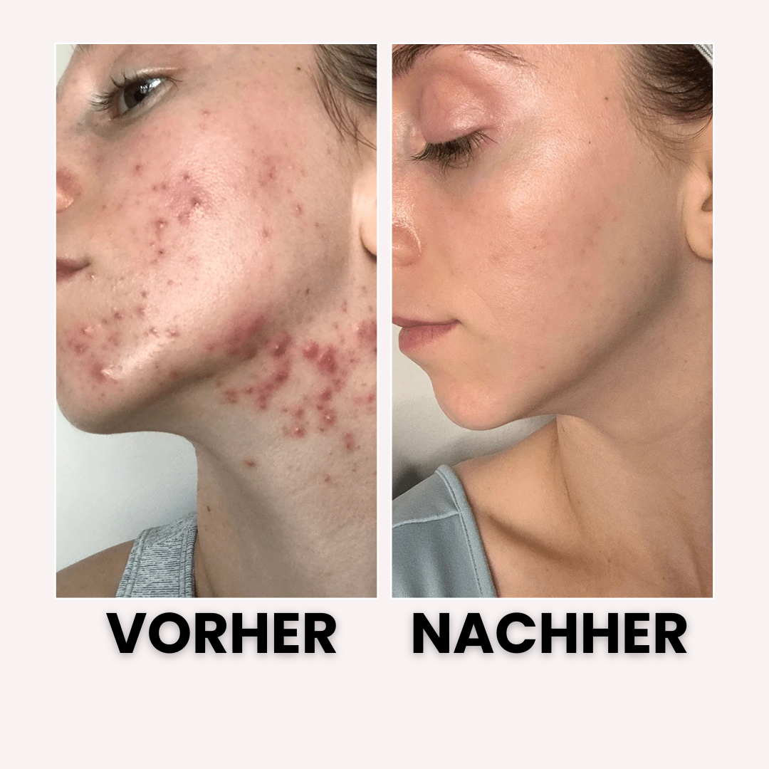 CleanBrush™ - Pinselreiniger